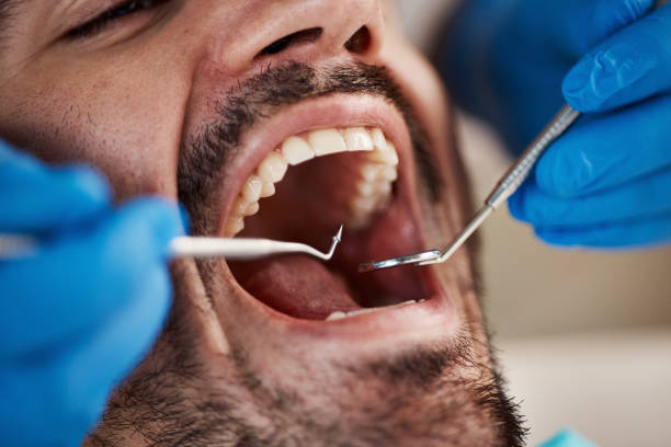 Best Oral Cancer Screening  in Grandview, WA